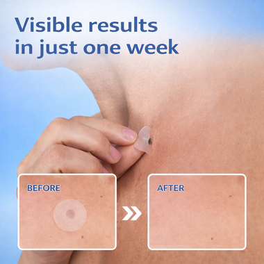 Dermavive ClearDot Precision Skin Clarifying Patches